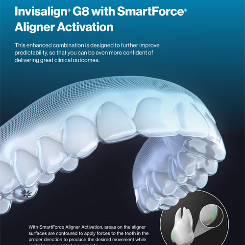 Invisalign® G8 with!SmartForce®
